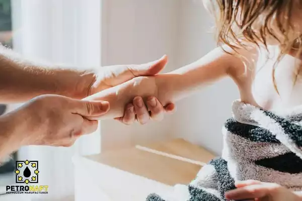 Mother greasing her child's hand with Vaseline or petroleum jelly