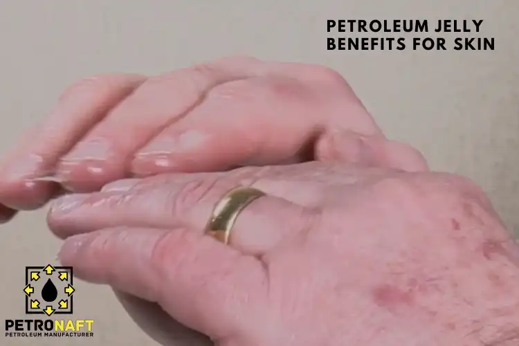 petroleum jelly benefits for skin