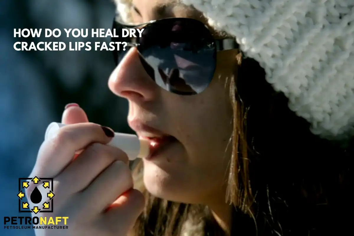 heal dry cracked lips